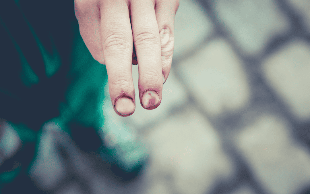 Navigating Child Injury Laws in South Dakota