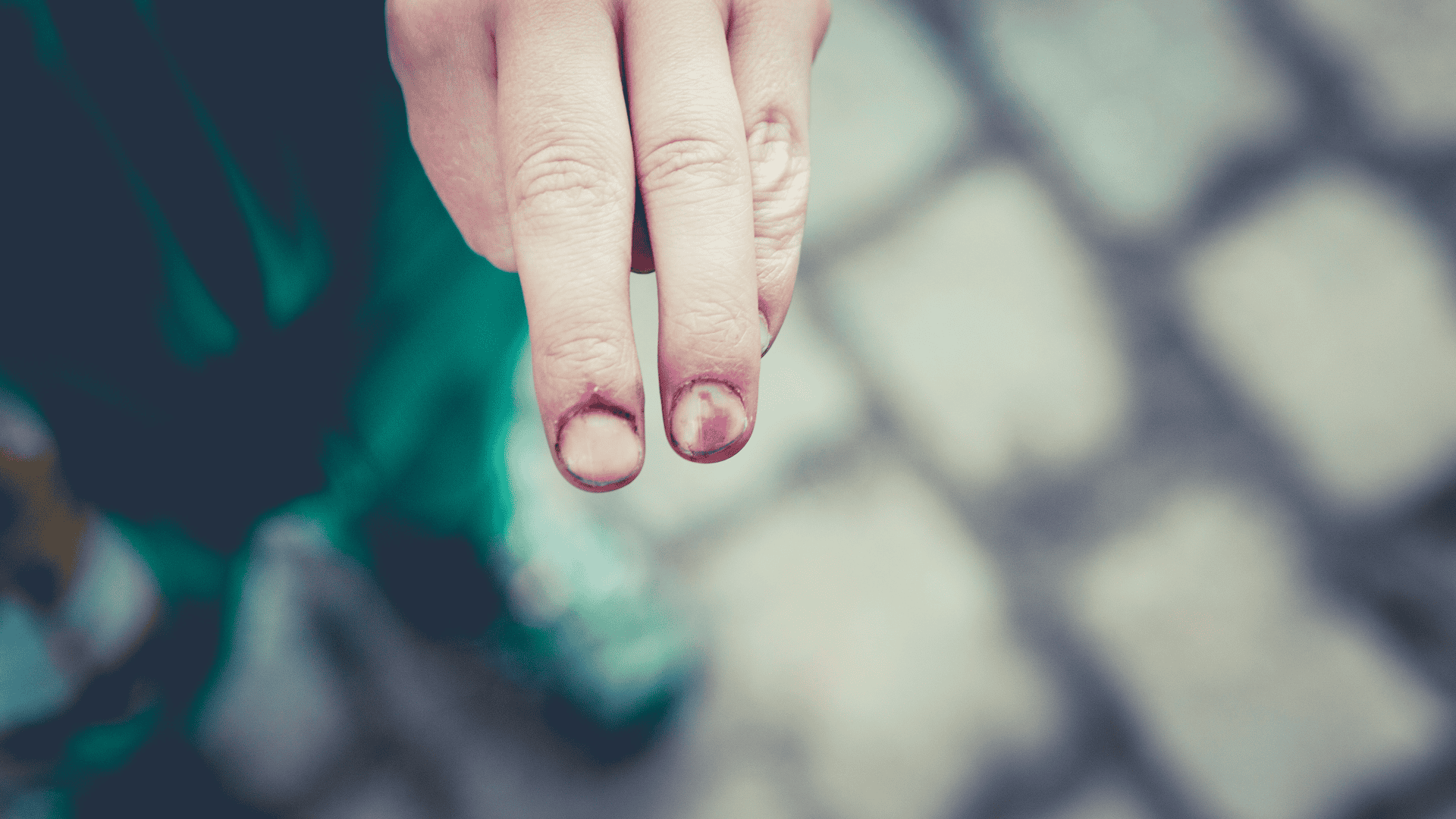 child injury on fingers